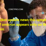 Rajkot update news this symptom of omicron appears only on the skin full guide in 2024